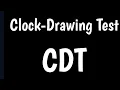 Clock-Drawing Test CDT Test Test For Alzheimer s Disease