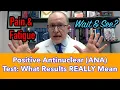 Positive Antinuclear ANA Antibodies Test What the Results REALLY Mean