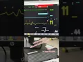 Download Lagu Detik-detik kematian yang terpantau Monitor ICU.
