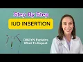 IUD Insertion Step by Step Guide by an OBGYN