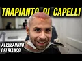 Download Lagu IL TRAPIANTO DI CAPELLI DI ALESSANDRO DELBIANCO