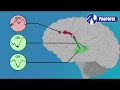 EEG for Anesthesiology - Part 3 Propofol