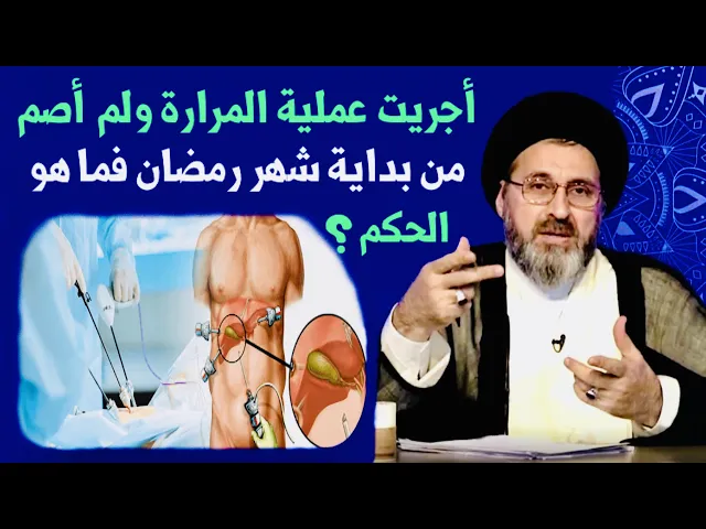 ⁣متصلة: أجريت عملية المرارة في رمضان ومن بداية شهر رمضان لم أصم فما هو الحكم ؟ | السيد رشيد الحسيني
