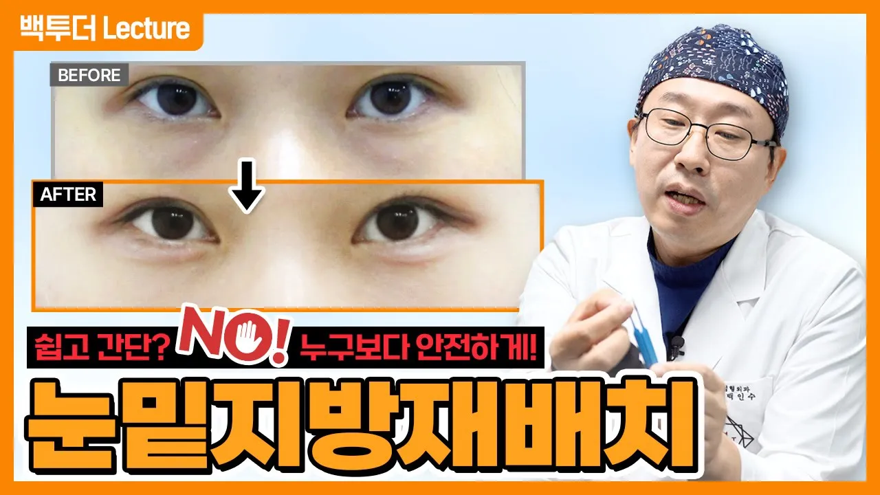 [눈밑지방재배치] 진짜 안전하냐고요? ※부작용 포함 다 알려드림※
