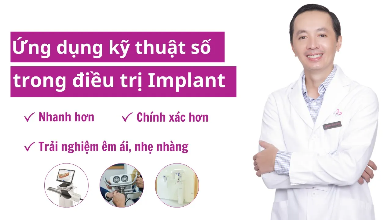Outline Video Công nghệ trồng răng Implant | Nha khoa đầu tiên tại VN ứng dụng PIC System