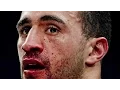 RICO VS BADR BREAKS ARM