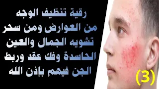 رقية الوجه شاملة وتنظيفه من العوارض وسحر تشويه الجمال والصورة والعين الحاسدة وفك عقد الجن بإذن الله 