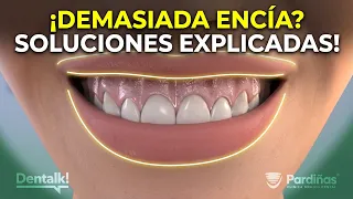 Sonrisa Gingival | ¿Por qué enseñas tanta encía al sonreír? - Todas las soluciones explicadas