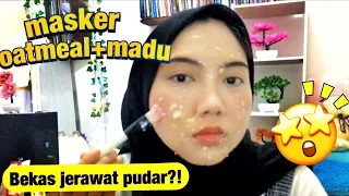 Download Masker Oatmeal+Madu | JERAWAT dan BEKAS JERAWAT hilang dengan cepat | HOAX/FACT MP3