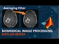 Averaging Filter MATLAB Code Implementation Medical Image Processing Computer Vision