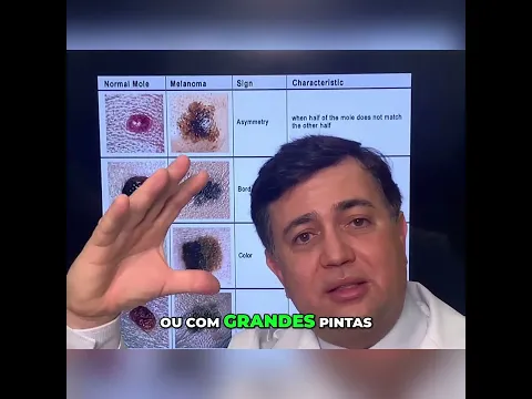 Manchas de nascimento e risco de melanoma #shorts