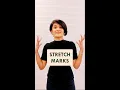Stretch Marks Derma MD clinincs Dr Tanvi Vaidya