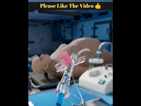 Alert 🚨 সব থেকে দামি সার্জারী 😮 @mayajaalbangla #shortsviral #shortvideos