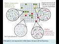 DNA Microarray Technology Tumor tissue Normal tissue