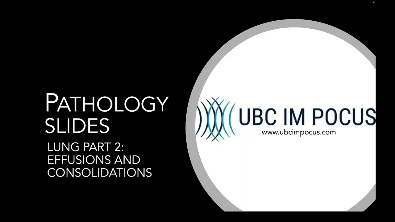 POCUS Pathology: Lung Part 2 - Consolidation and Effusions
