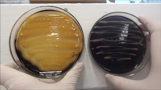 Provas Bioquímicas