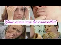 A New You Skin Spa Acne Clinic - Acne Treatment Ad