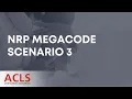 NRP Megacode Scenario 3 ACLS Certification Association