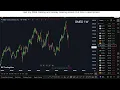 GMED Stock MASSIVE UPDATE buy now or what Globus Medical stock analysis best broker review