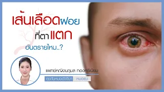  เส้นเลือดฝอยที่ตาแตกเกิดจากอะไรบ้าง 