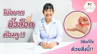 อาการของนิ้วล็อคแบ่งเป็นกี่ขั้น และแต่ละขั้นมีลักษณะอย่างไร