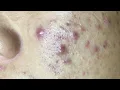 Satisfying and Relaxation with SURI NGUYEN Beauty Spa