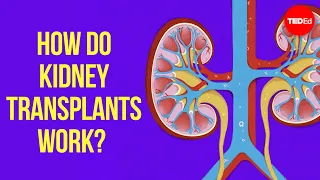 how does kidney transplant surgery work alexander h toledo