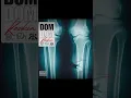 Keskin - DOMDOM şerif