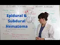 Epidural and Subdural Hematoma