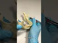 Nail Your Inferior Alveolar Blocks OnlineExodontia com