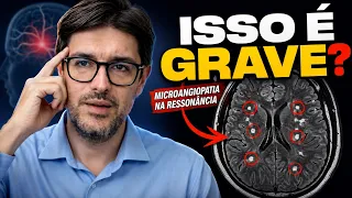 Manchas na Ressonância do Cérebro: O que é Microangiopatia [Neurologista Explica]