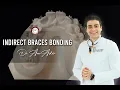 Indirect braces bonding step by step by Memosil as a transfer tray in orthodontics by Dr Amr Asker