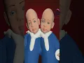 How conjoined twins are formed 3D Animation