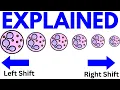 CBC Left Shift vs Right Shift Differential Count Explained USMLE Exams