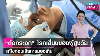  ต้อกระจกเกิดจากสาเหตุอะไรบ้าง 