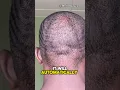 Download Lagu Best Haircut To Start 360 Waves
