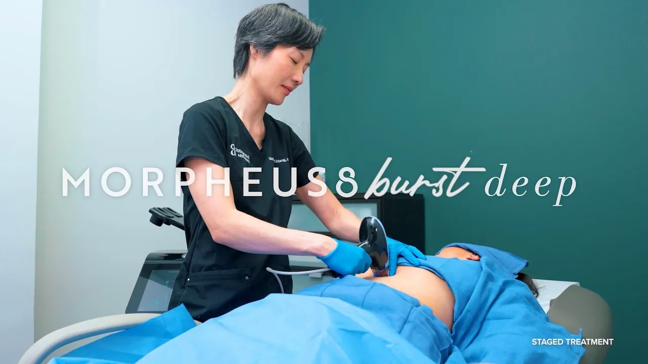 Morpheus8 Burst Deep: The Ultimate Non-Surgical Body Tightening Treatment