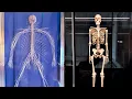 Anatomy Beyond Cadavers