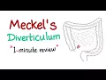 Download Lagu Meckel's Diverticulum (1-minute review)