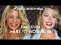 Blake Lively Plastic Surgery Plastic Surgeon Reacts to Gossip Girl Nose Jobs