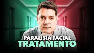 Paralisia Facial de Bell - Qual o Melhor Tratamento