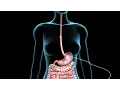Download Lagu PEG | Feeding Tube | Nucleus Health