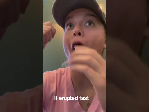 It erupted fast