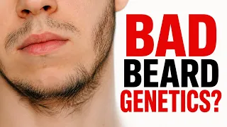 Bad Beard Genetics