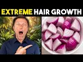 Lagu Onion Juice for Extreme Hair Growth: Stop Hair Loss