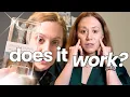 AngelLift 30 Day Experiment - Botox Alternative