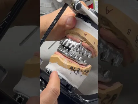 Why am I making this case a SYTON 7-Star restoration
