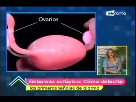 Embarazo ectópico: Cómo detectar las primeras señales de alarma