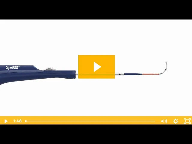 Balloon Sinus Surgery | Otolaryngology In Oceanside, CA | ENT