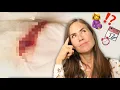 Implantation Bleeding What It Is and What to Look For